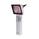 Horus Scope Digital Video Otoscope with in-built screen & Rechargeable Handle