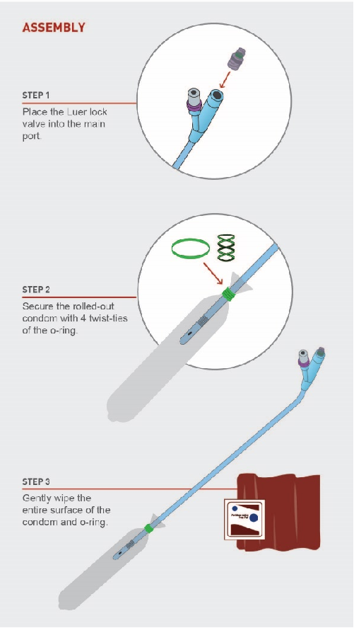 Dr Burke’s ESM-UBT kit