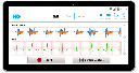 HD STETH – Intelligent Stethoscope with Integrated EKG