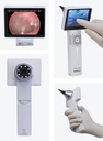 Horus Scope Digital Video Otoscope with in-built screen & Rechargeable Handle