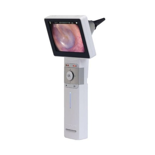 [HORUS_SCOPE_DIGI_VIDEO_OTO] Horus Scope Digital Video Otoscope with in-built screen & Rechargeable Handle